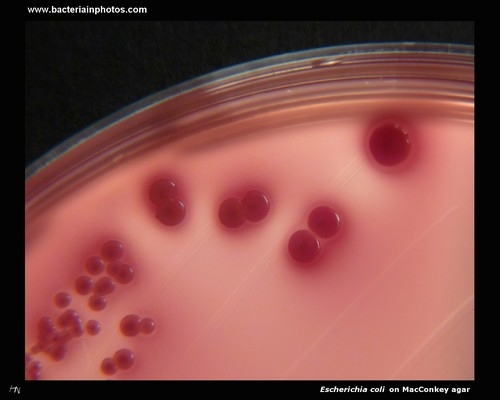 escherichia coli colonies on MacConkey agar